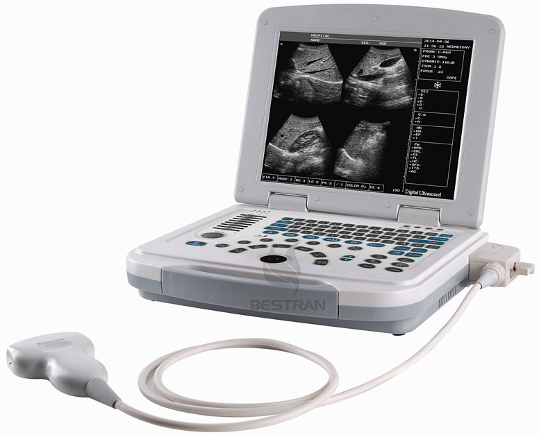 Full-digital laptop Ultrasound Diagnostic System