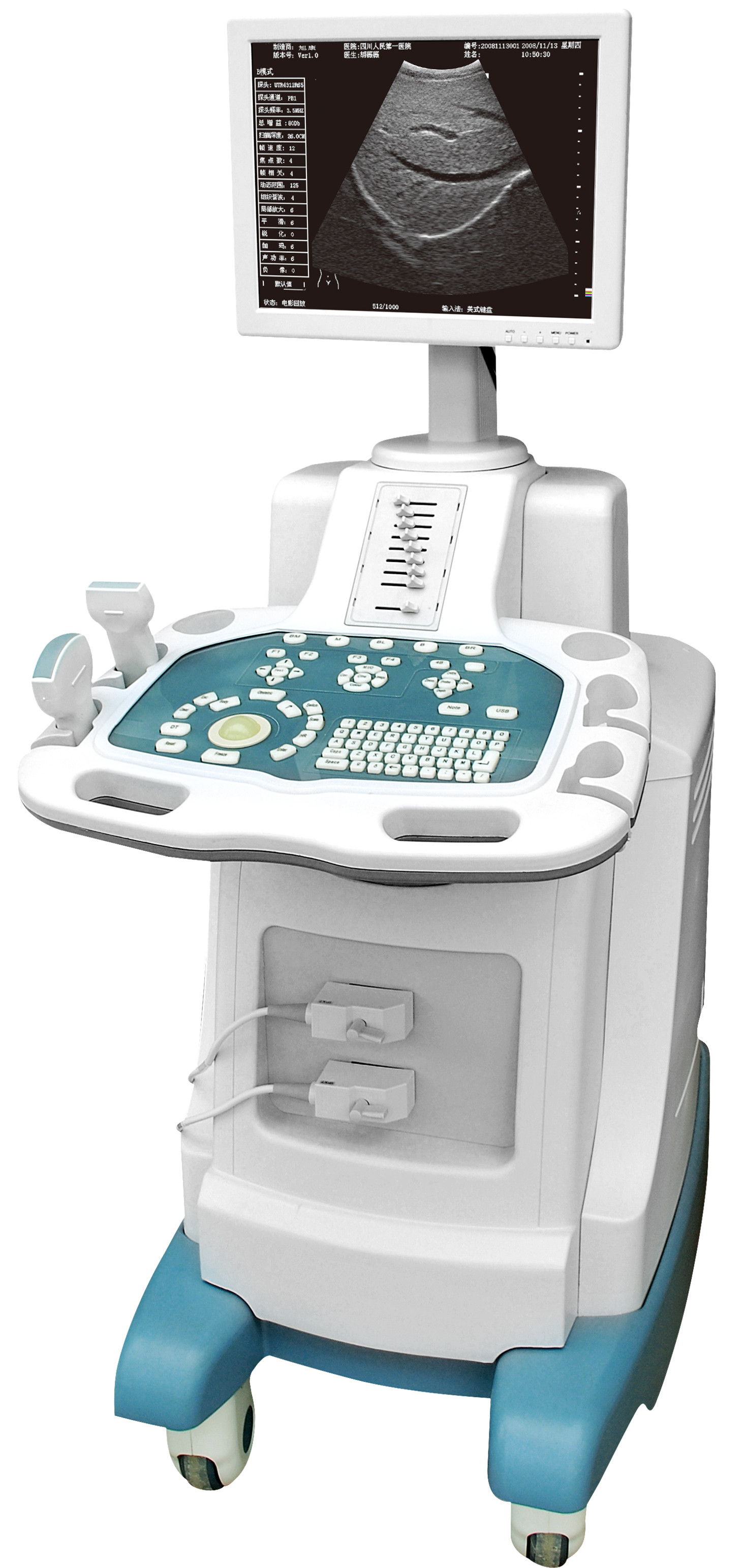 Full-digital Trolley Ultrasound Scanner(80 elements)