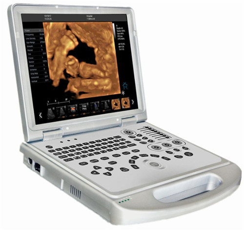 4D laptop color doppler ultrasound system