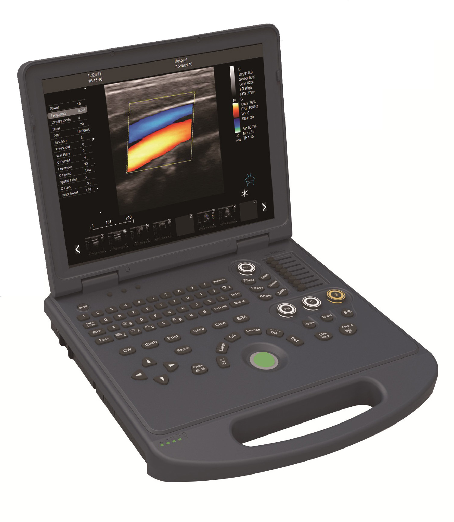 Doppler color portátil Sistema de diagnóstico por ultrasonido