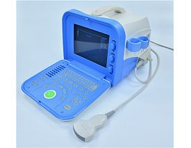 Full-digital Portable Ultrasound Scanner