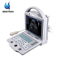 Máquina de escáner de ultrasonido humano