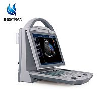 Escáner de ultrasonido Doppler color digital completo （Humano)