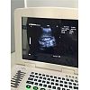 Escáner de ultrasonido portátil